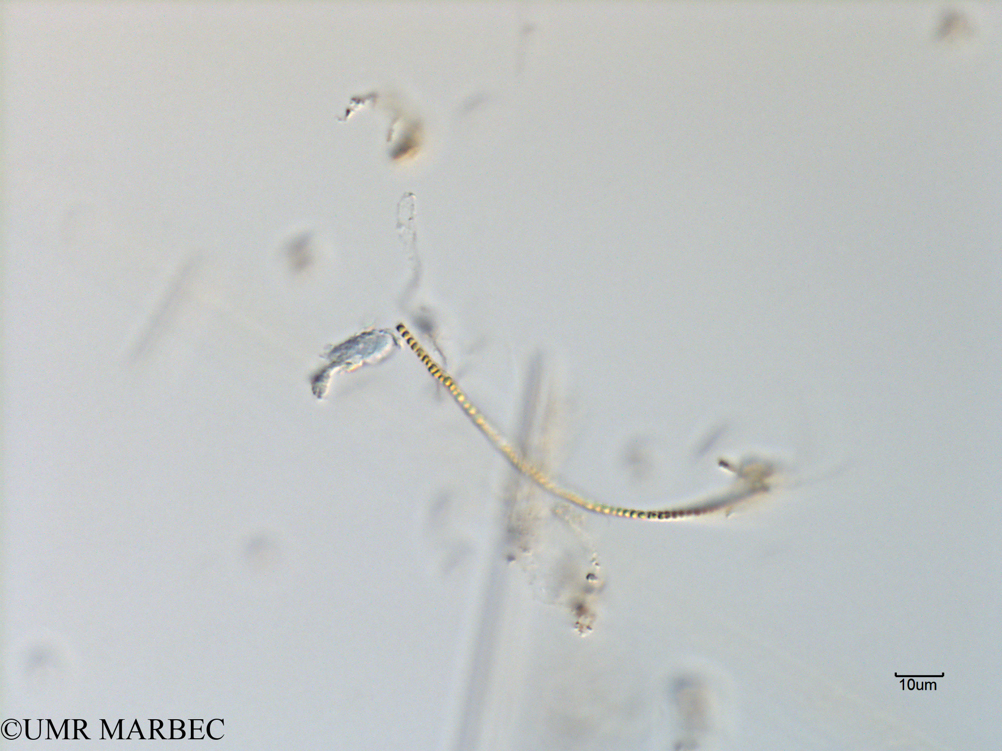 phyto/Scattered_Islands/mayotte_lagoon/SIREME May 2016/Oscillatoriale spp (MAY11_cyano2).tif(copy).jpg